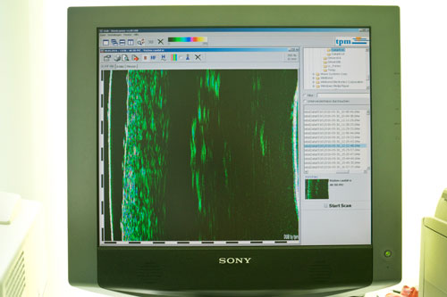 Ein 20-MHz-Ultraschallbild normaler Haut wird auf einem Bildschirm angezeigt